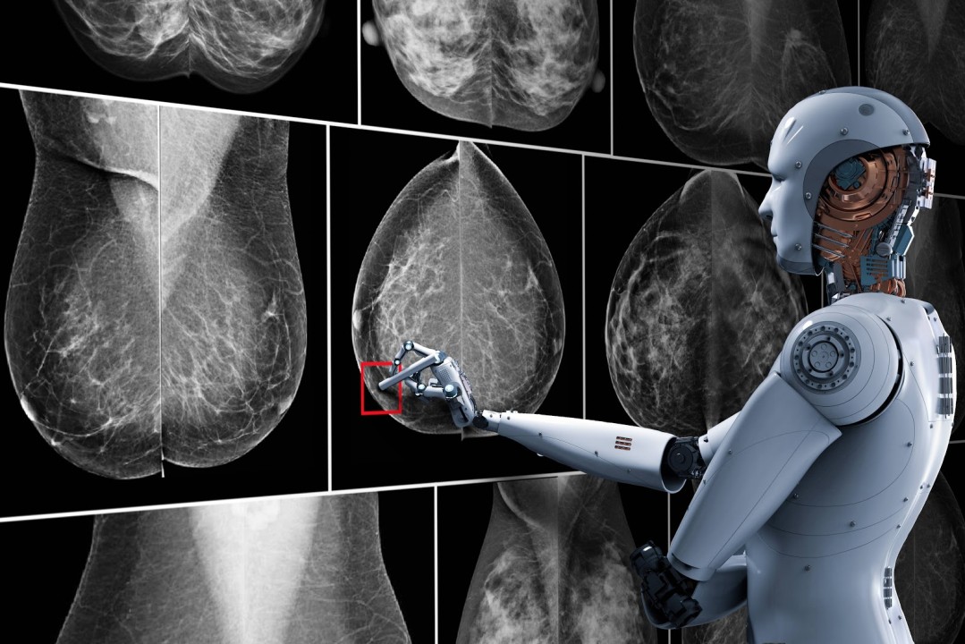 Imagen de artículo El Futuro del Tecnólogo Médico en Radiología frente al Avance de la Inteligencia Artificial